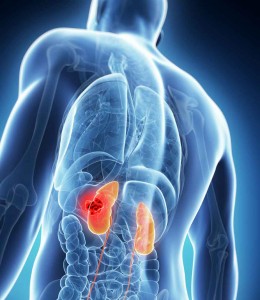 kidney-steroids-side-effects